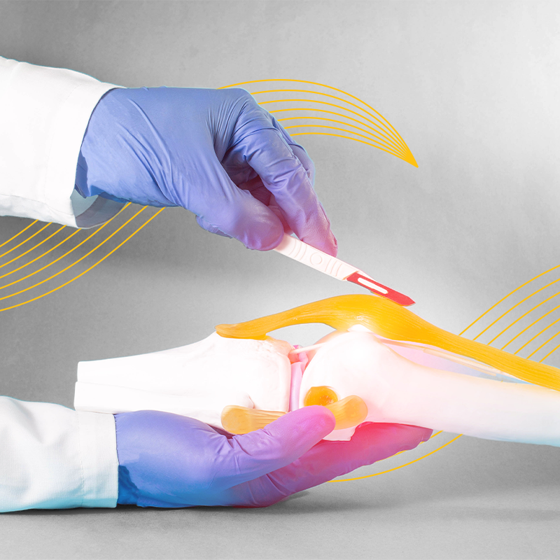 Post-operative Pain Control after Knee Replacement